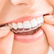 Types Of Braces