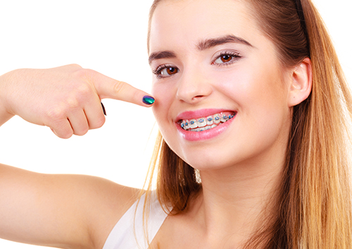 Affordable Braces for Adults in Chula Vista